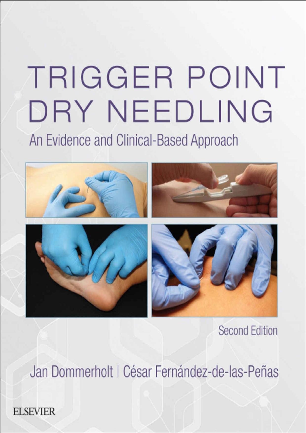 Trigger Point Dry Needling E-Book by Jan Dommerholt & Cesar Fernandez de las Penas