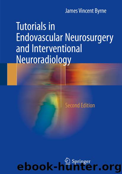 Tutorials in Endovascular Neurosurgery and Interventional Neuroradiology by James Vincent Byrne