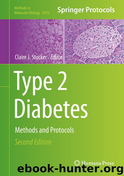 Type 2 Diabetes by Claire J. Stocker