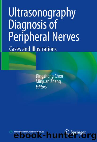 Ultrasonography Diagnosis of Peripheral Nerves by Unknown