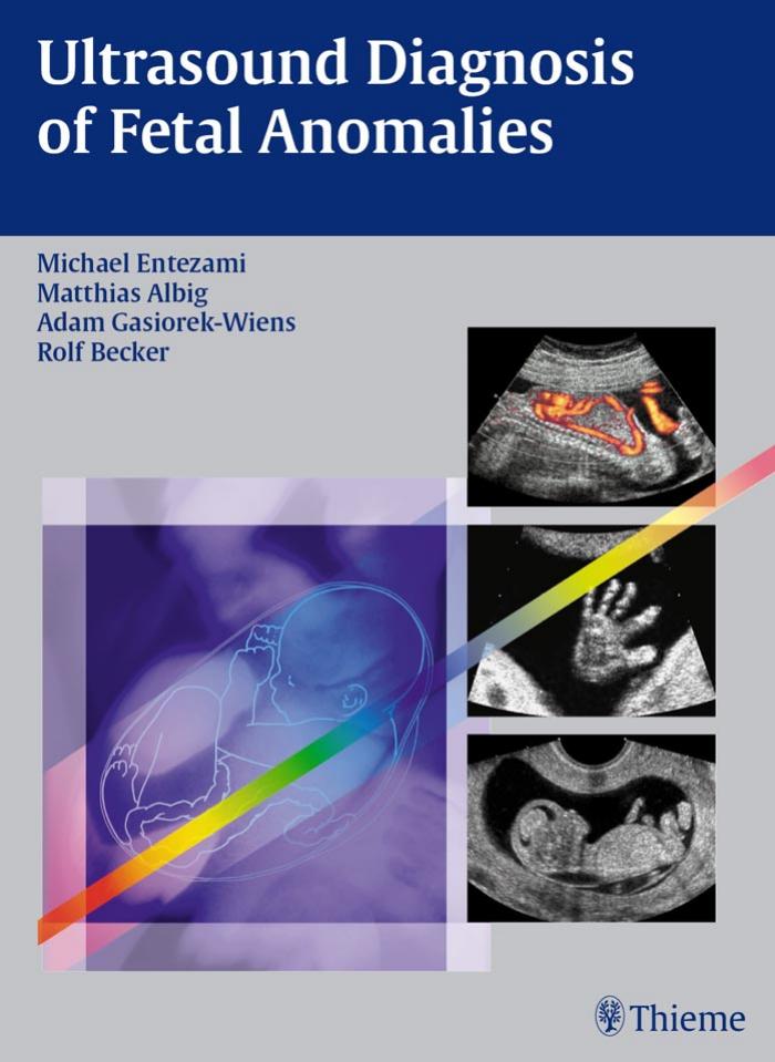 Ultrasound Diagnosis of Fetal Anomalies by Michael Entezami Matthias Albig Adam Gasiorek-Wiens Rolf Becker