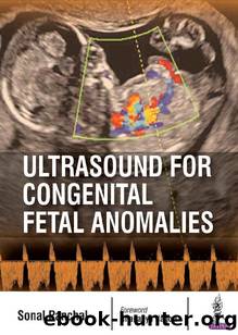Ultrasound for Congenital Fetal Anomalies by Sonal Panchal