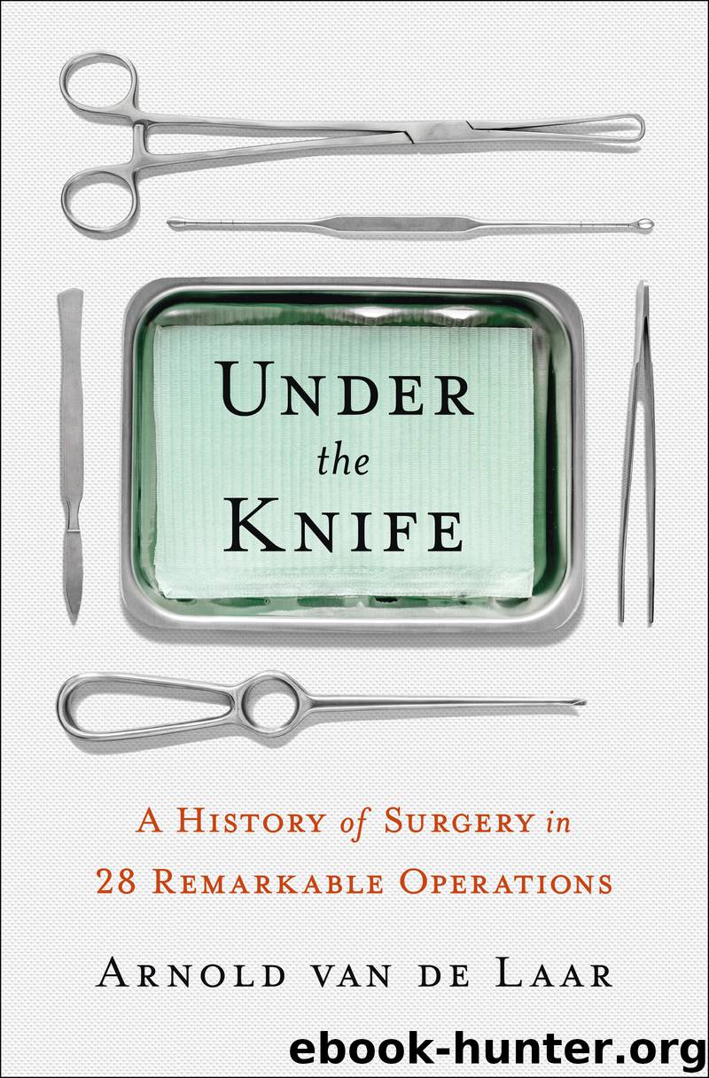 Under the Knife by Arnold van de Laar Laproscopic surgeon