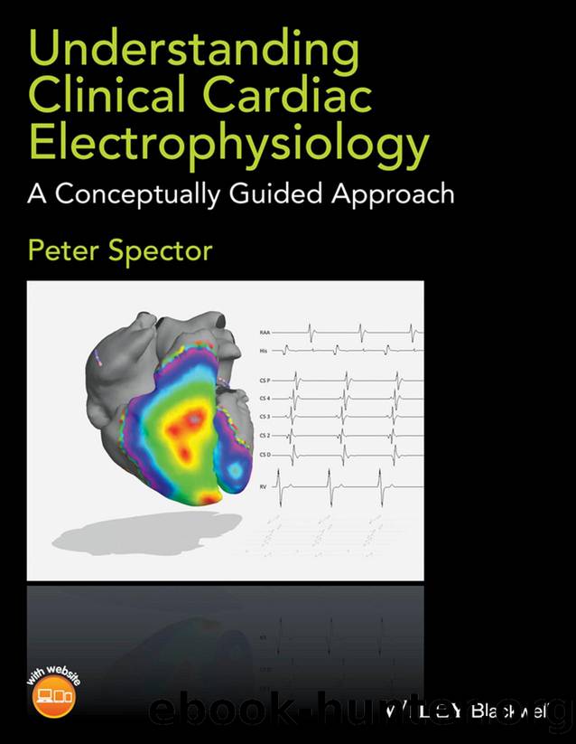 Understanding Clinical Cardiac Electrophysiology by Peter Spector