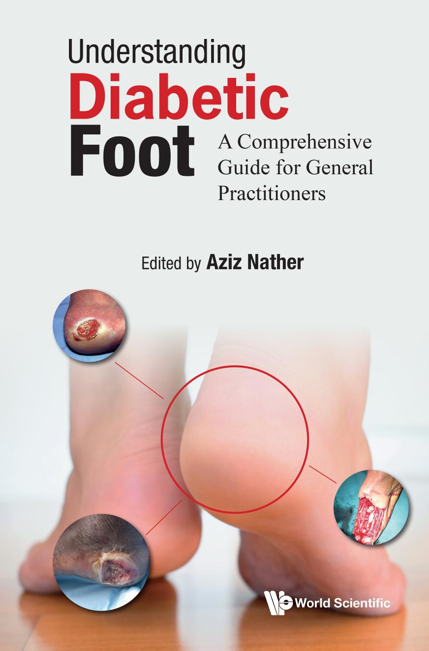 Understanding Diabetic Foot: A Comprehensive Guide For General Practitioners by Aziz Nather