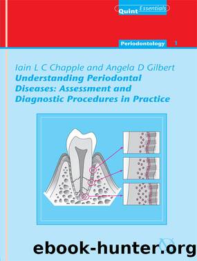 Understanding Periodontal Diseases by Gilbert Angela Chapple Iain