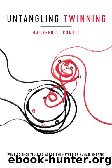 Untangling Twinning by Maureen L. Condic
