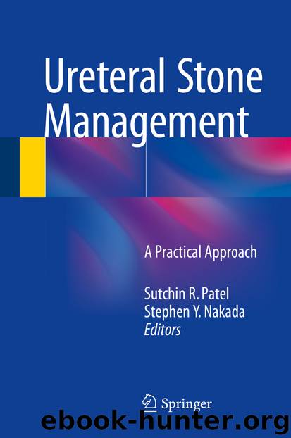 Ureteral Stone Management by Sutchin R. Patel & Stephen Y. Nakada