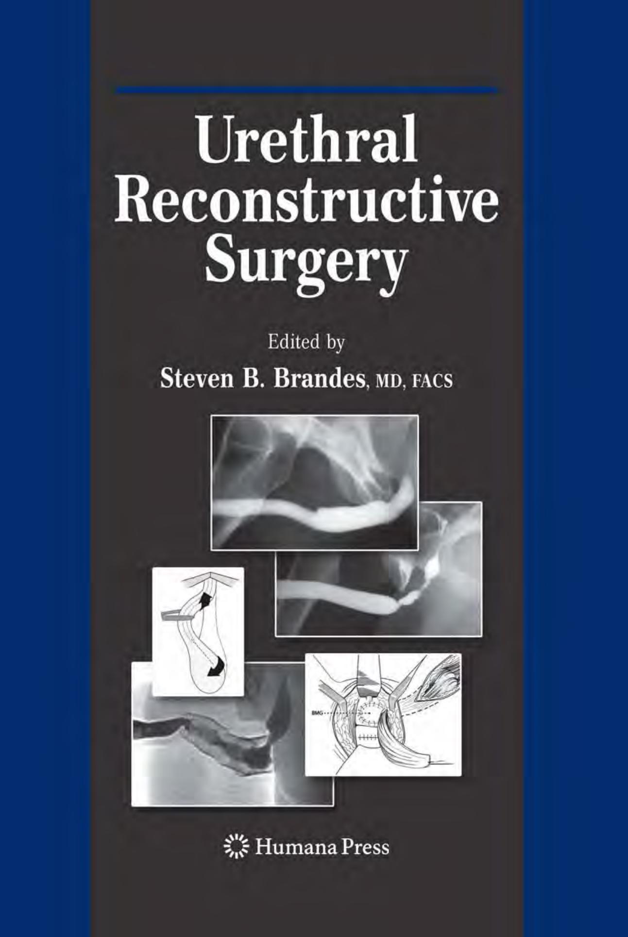 Urethral Reconstructive Surgery by Peter A. Humphrey MD PhD (auth.) Steven B. Brandes M.D. FACS (eds.)