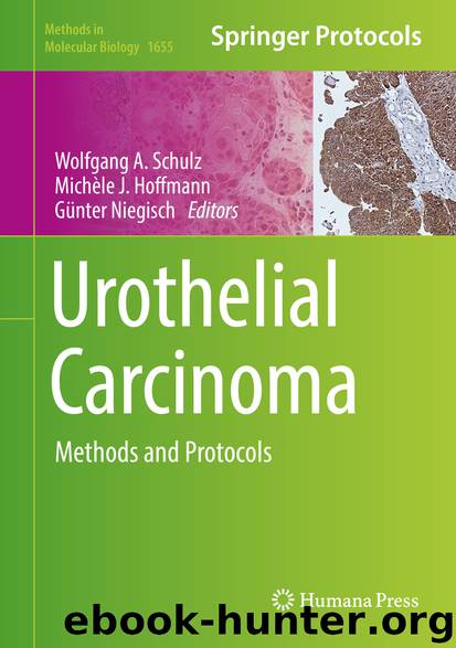 Urothelial Carcinoma by Wolfgang A Schulz Michèle J. Hoffmann & Günter Niegisch