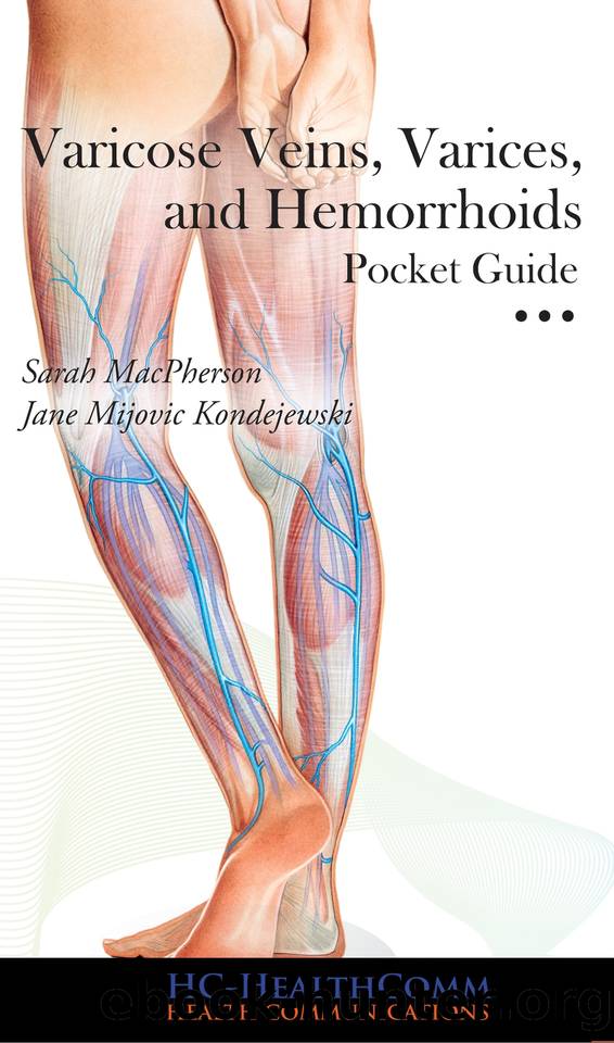 Varicose Veins, Varices and Hemorrhoids Pocket Guide: Full illustrated 2016 by HC-HealthComm
