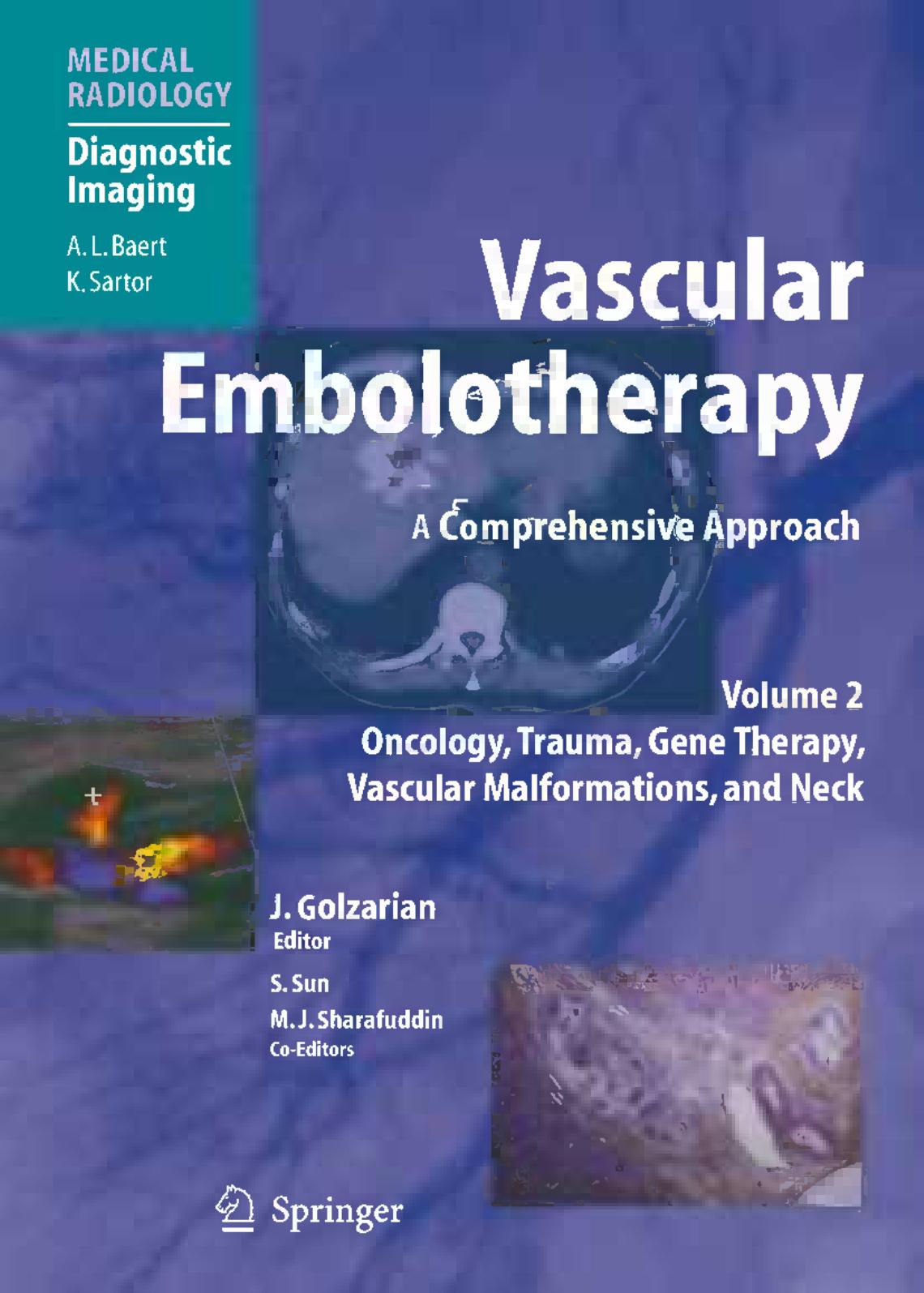 Vascular Embolotherapy: A Comprehensive Approach Volume 2 Oncology, Trauma, Gene Therapy, Vascular Malformations, and Neck by unknow