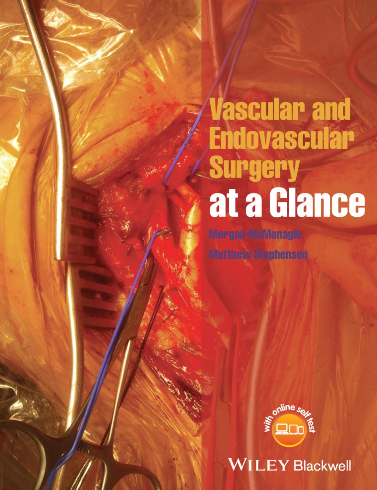 Vascular and Endovascular Surgery at a Glance by Morgan McMonagle Matthew Stephenson