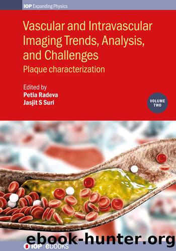 Vascular and Intravascular Imaging Trends, Analysis, and Challenges, Volume 2: Plaque characterization by Petia Radeva Jasjit S Suri