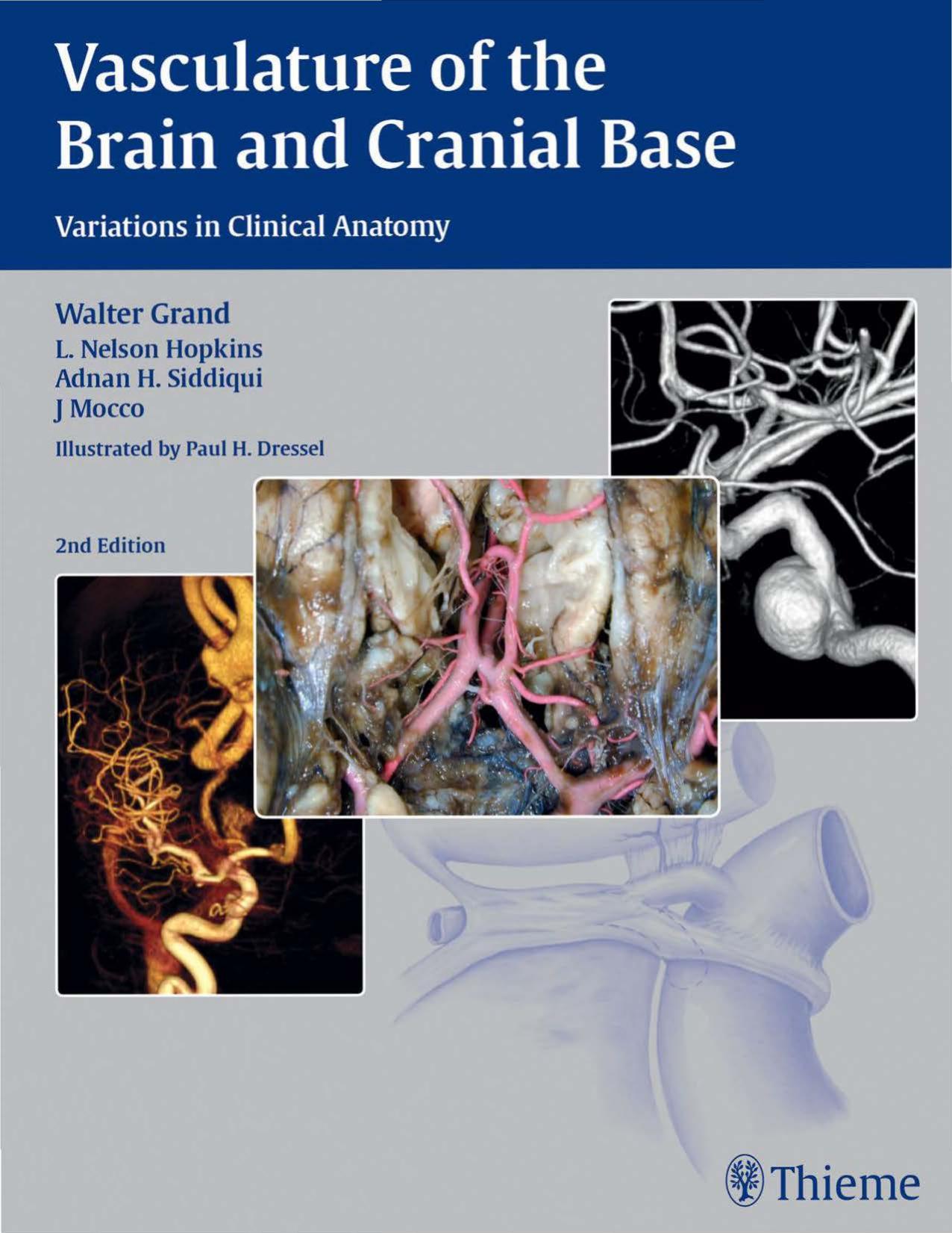 Vasculature of the brain and cranial base : variations in clinical anatomy by Adnan H. Siddiqui; L. N. Hopkins; Walter Grand; J. Mocco
