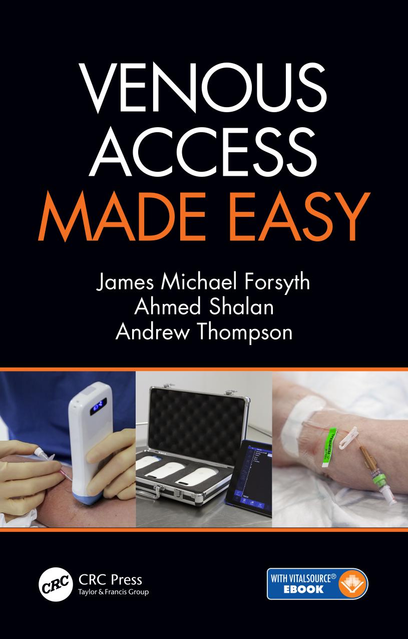Venous access made easy by Forsyth James Michael; Shalan Ahmed; Thompson Andrew Roger