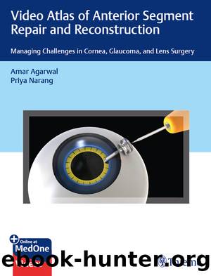Video Atlas of Anterior Segment Repair and Reconstruction by Amar Agarwal;Priya Narang;