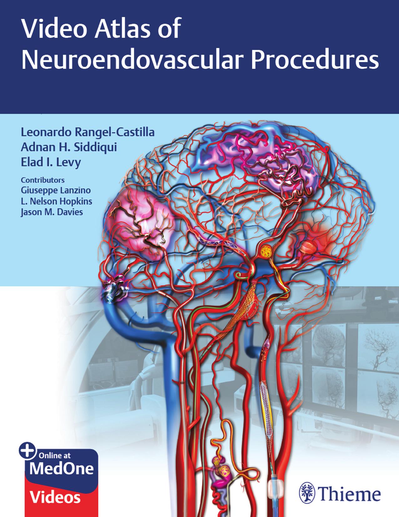 Video Atlas of Neuroendovascular Procedures by Unknow