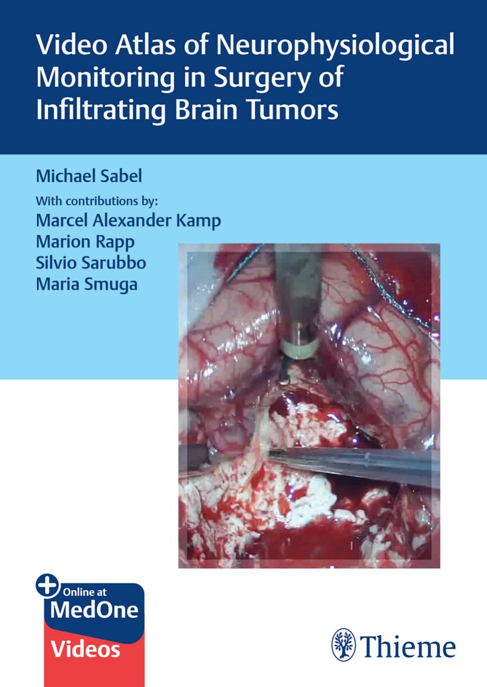 Video Atlas of Neurophysiological Monitoring in Surgery of Infiltrating Brain Tumors by Michael Christoph Sabel