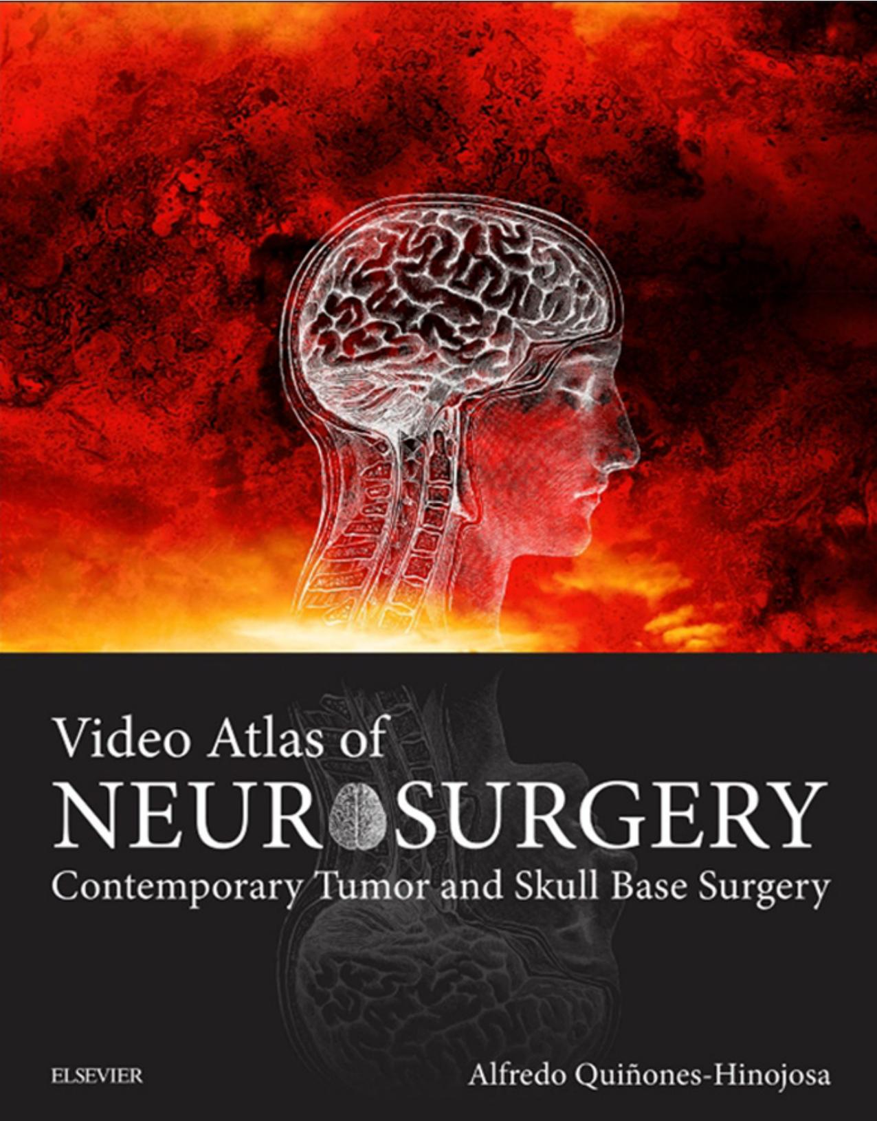 Video Atlas of Neurosurgery: Contemporary Tumor and Skull Base Surgery by Alfredo Quinones-Hinojosa
