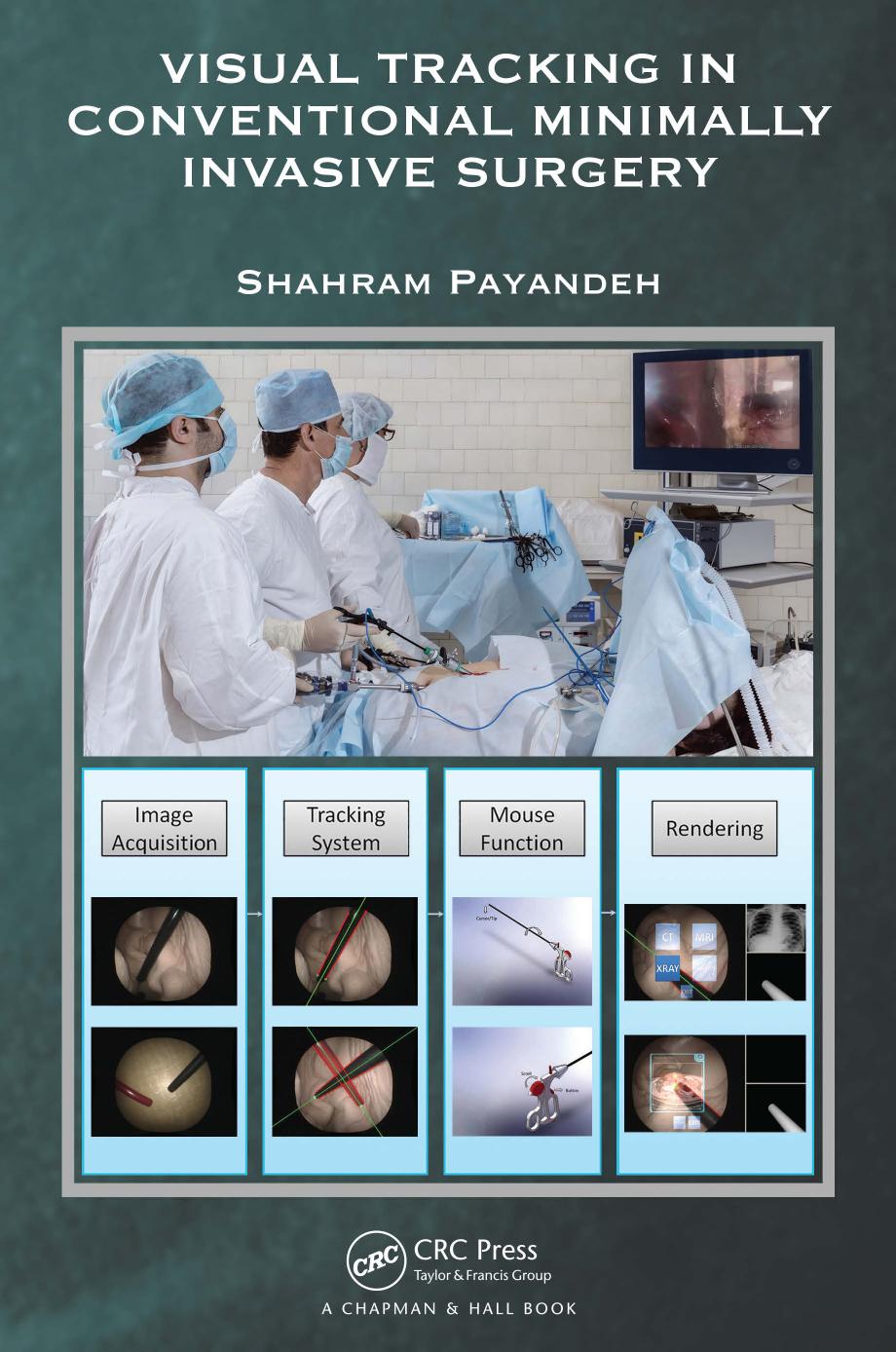 Visual Tracking in Conventional Minimally Invasive Surgery by Shahram Payandeh