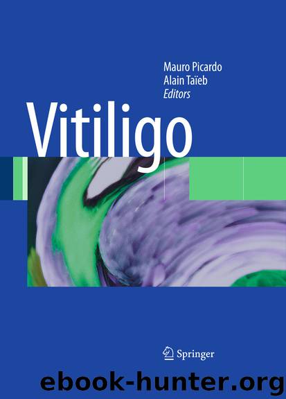 Vitiligo by Mauro Picardo & Alain Taïeb