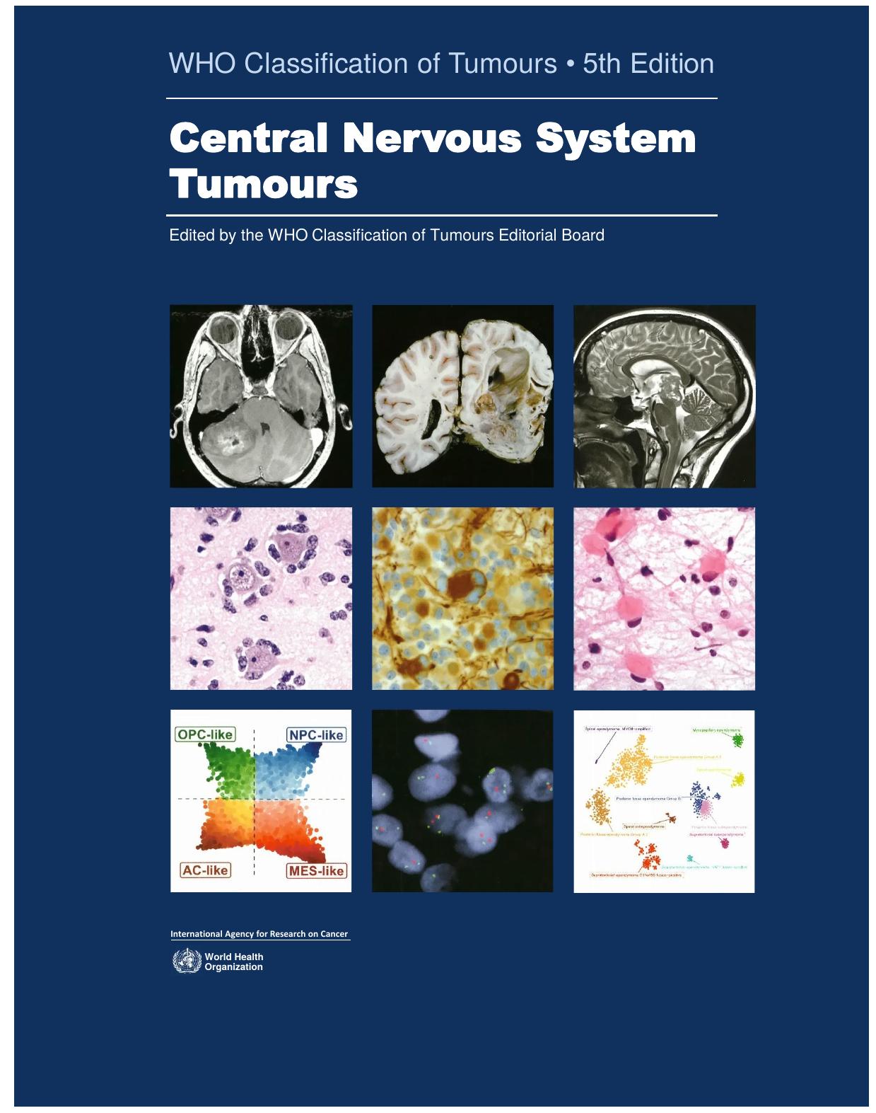 WHO Classification of Tumours - Central Nervous System Tumours, 5th Edition by unknow