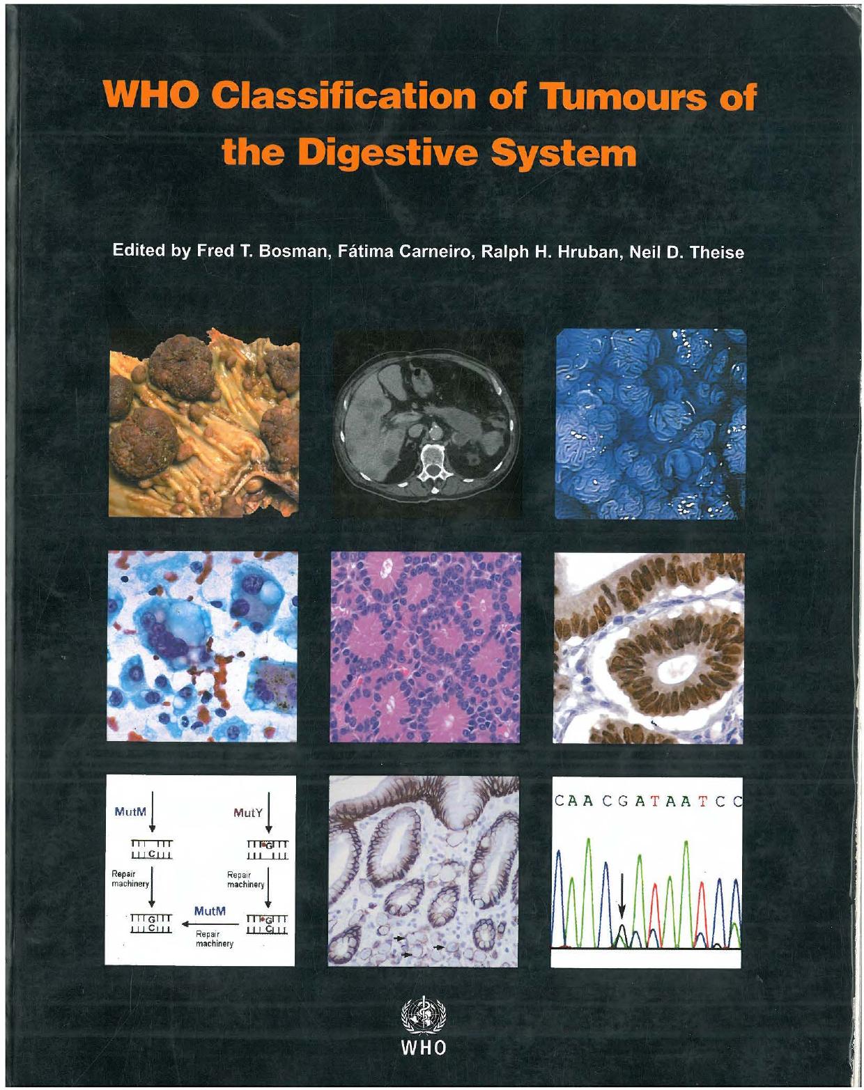 WHO Classification of Tumours of the Digestive System by Bosman FT Carneiro F Hruban RH Theise ND