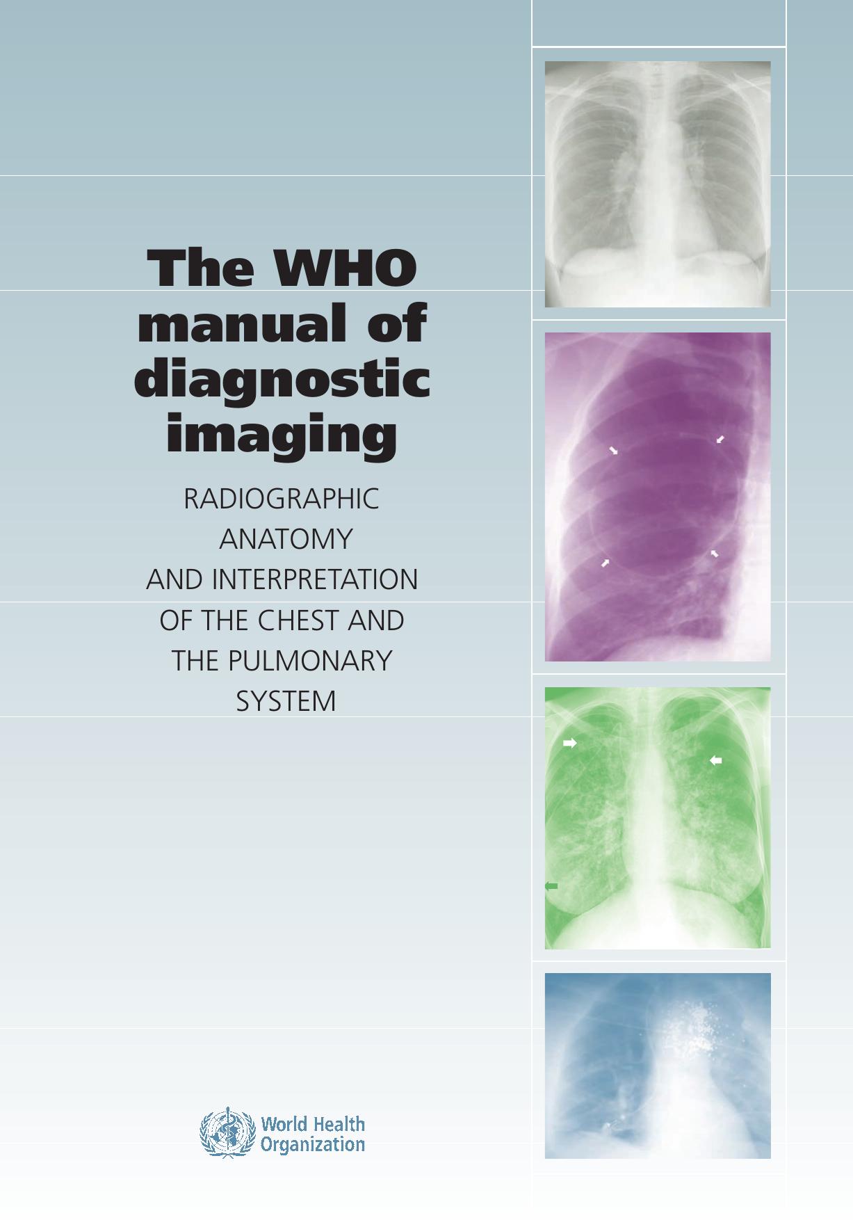 WHO Manual of Diagnostic Imaging: Radiographic Anatomy and Interpretation of the Chest by WHO