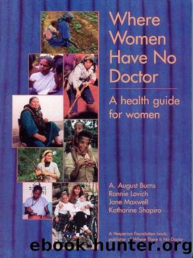 Where Women Have No Doctor: A Health Guide for Women by Burns Arlene August