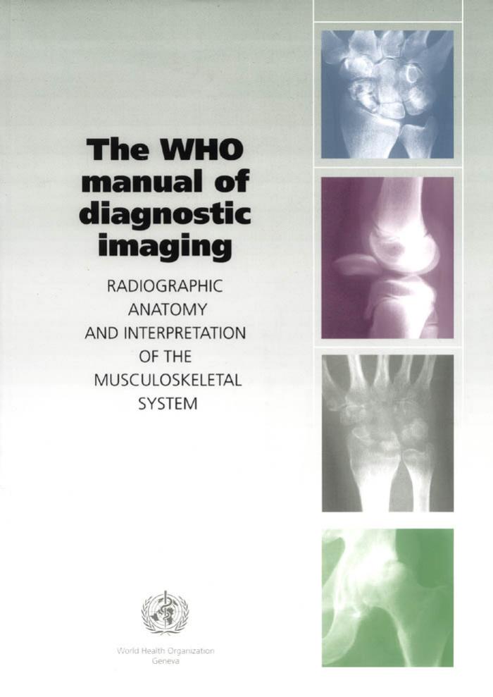 Who Manual Of Diagnostic Imaging Radiographic Anatomy And Interpretation Of The Muskuloskeletal by Seyed B. Mostofi
