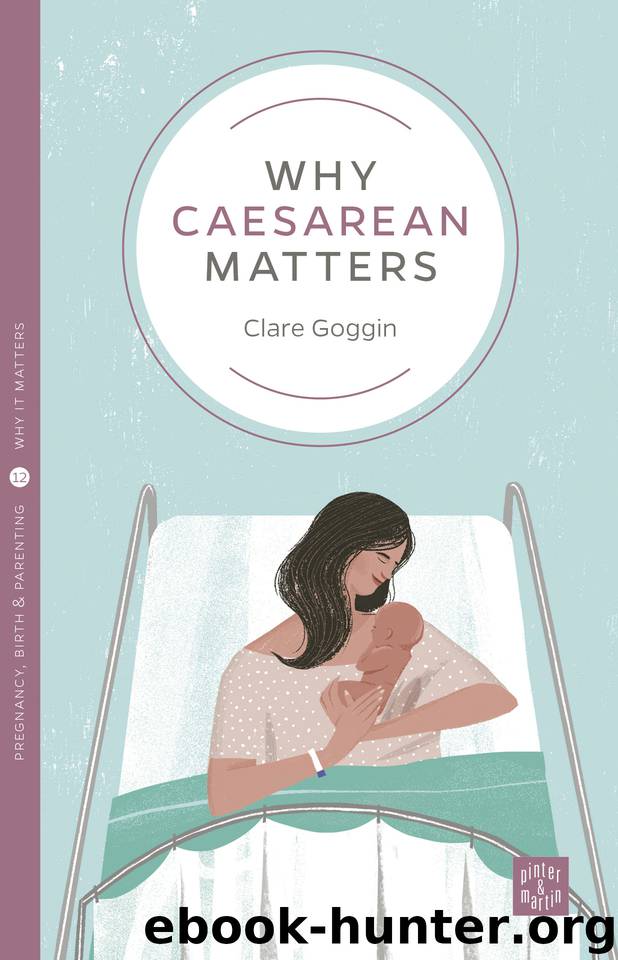 Why Caesarean Matters (Why It Matters Book 12) by Goggin Clare