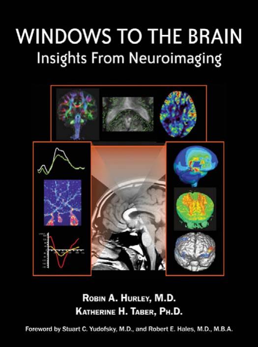 Windows to the Brain: Insights From Neuroimaging by Robin A. M.D. Hurley Katherine H. Ph.D. Taber