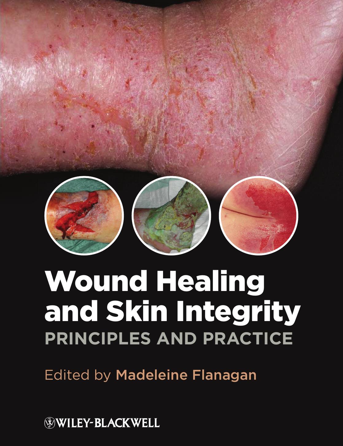Wound Healing and Skin Integrity: Principles and Practice Edition 1 by Madeleine Flanagan