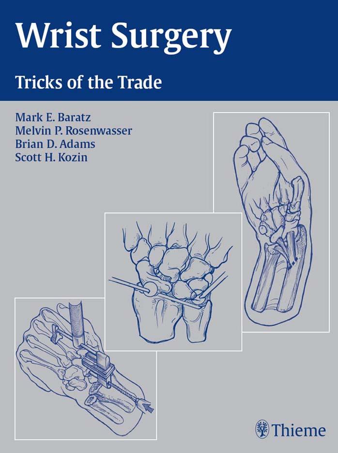 Wrist surgery: tricks of the trade by Mark E. Baratz Melvin P. Rosenwasser Brian D. Adams Scott H. Kozin