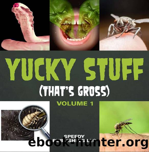 Yucky Stuff (That's Gross Volume 1) by Speedy Publishing