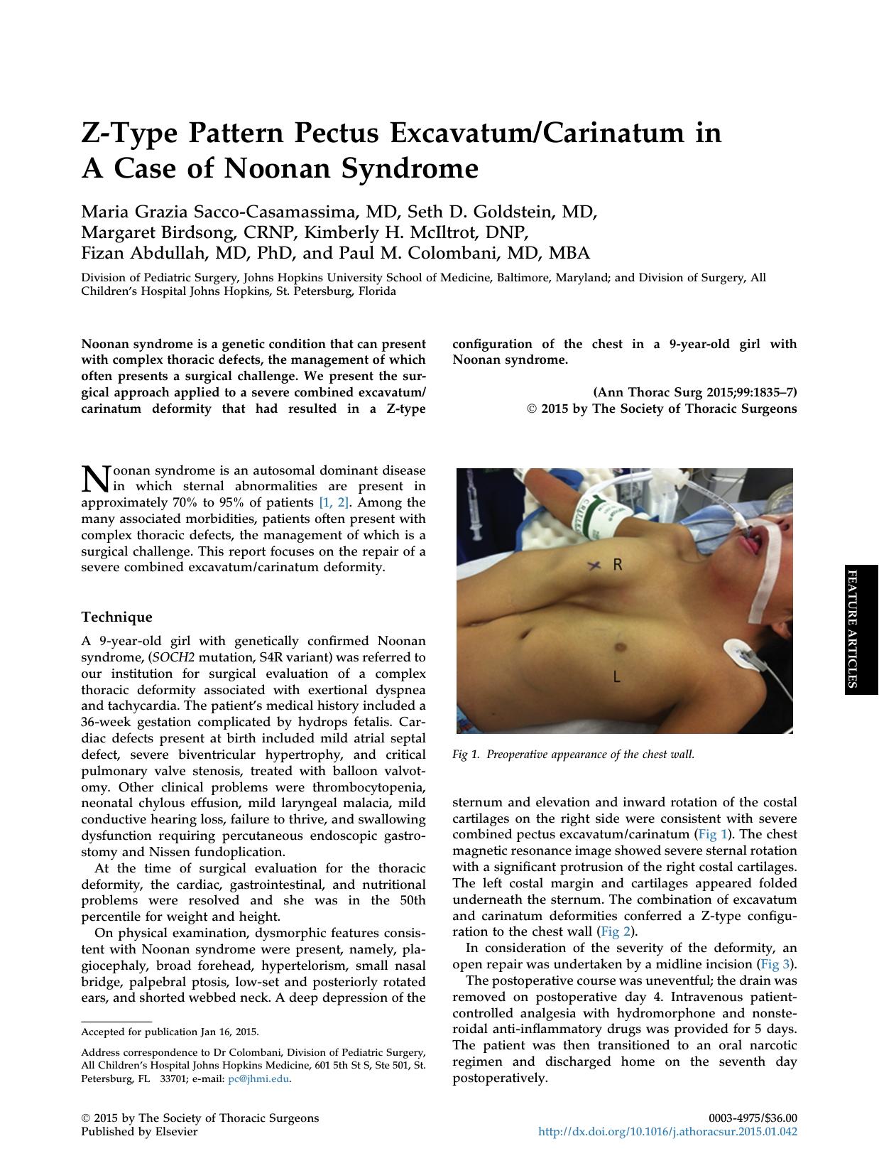 Z-Type Pattern Pectus ExcavatumCarinatum in A Case of Noonan Syndrome by unknow