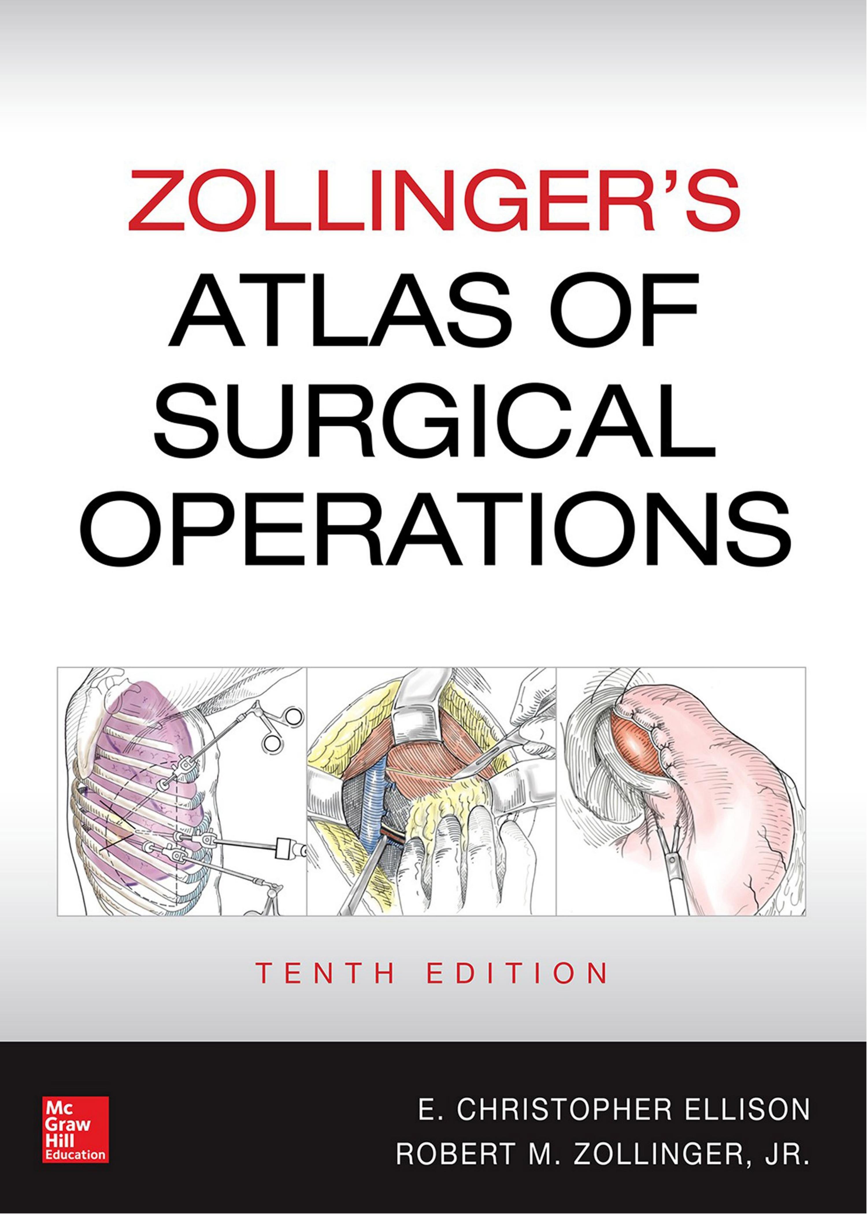 Zollinger's Atlas of Surgical Operations 10 by Unknown
