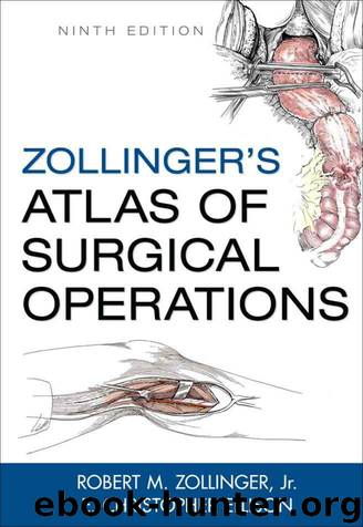 Zollinger's Atlas of Surgical Operations, Ninth Edition by Robert M. Zollinger Jr. & E. Christopher Ellison