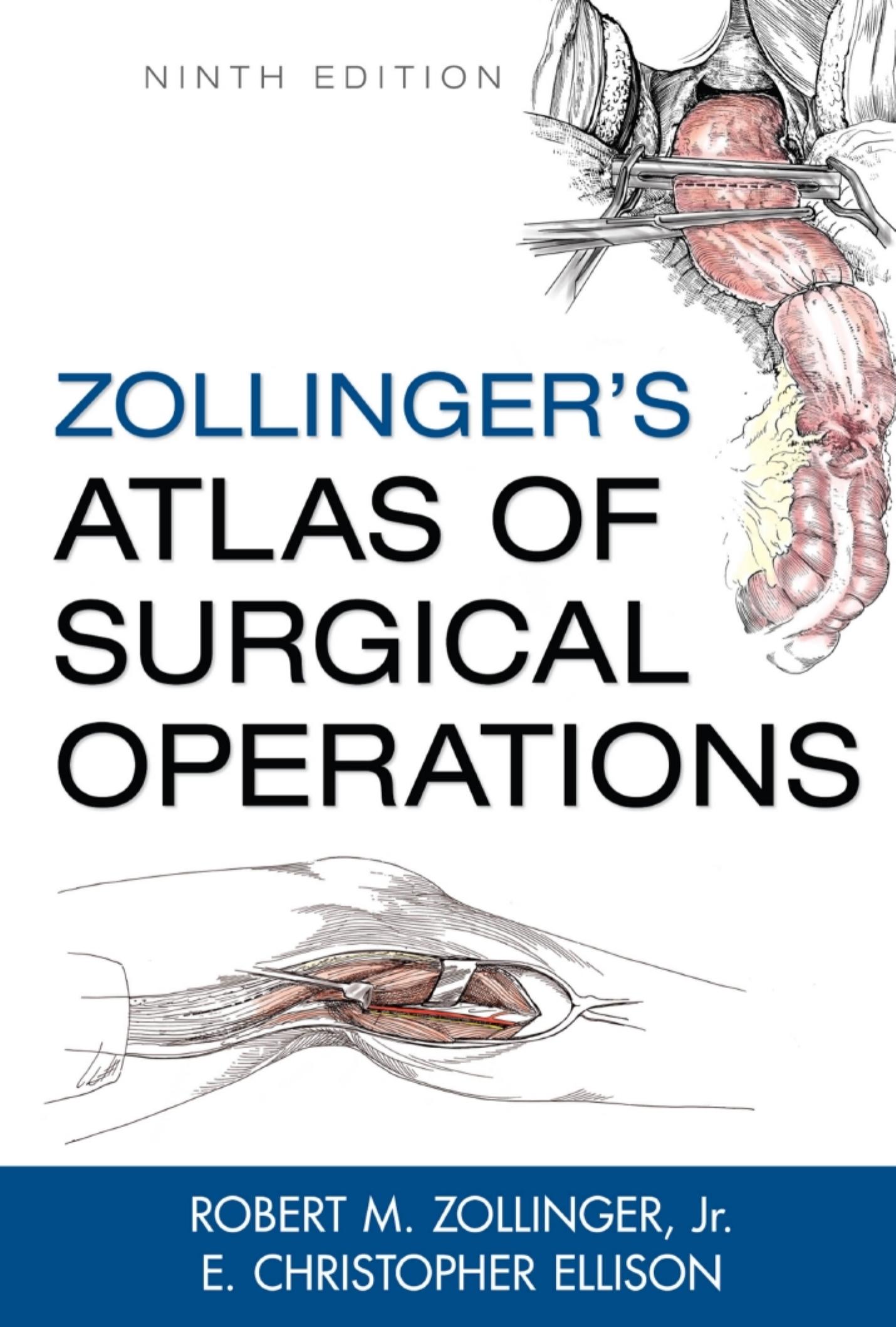 Zollingerâs Atlas of Surgical Operations 9th Edition by Unknown