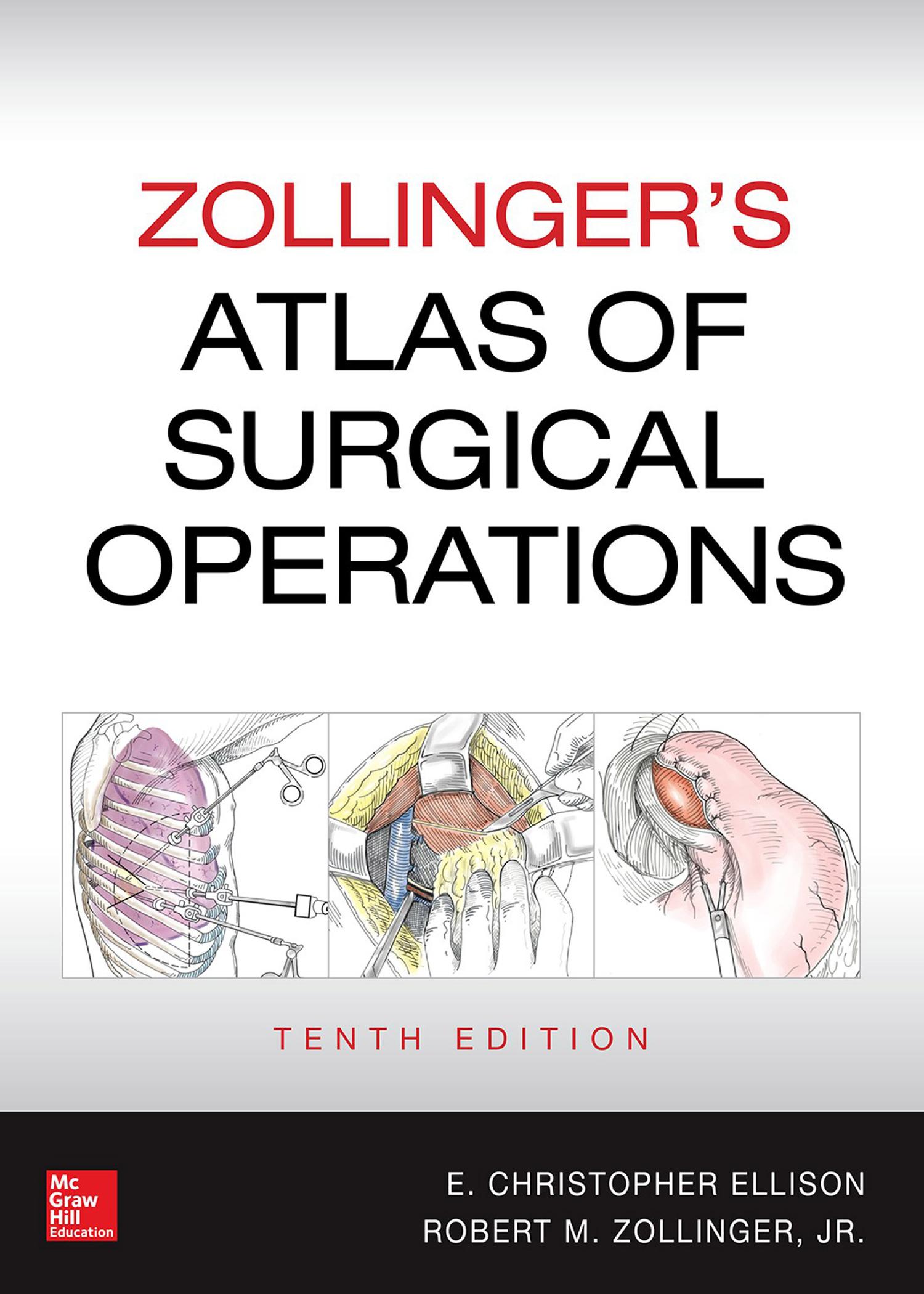 Zollingerâs Atlas of Surgical Operations by Robert M. Zollinger E. Christopher Ellison
