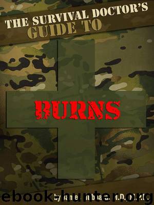 a survival book to Burns by John Hubert