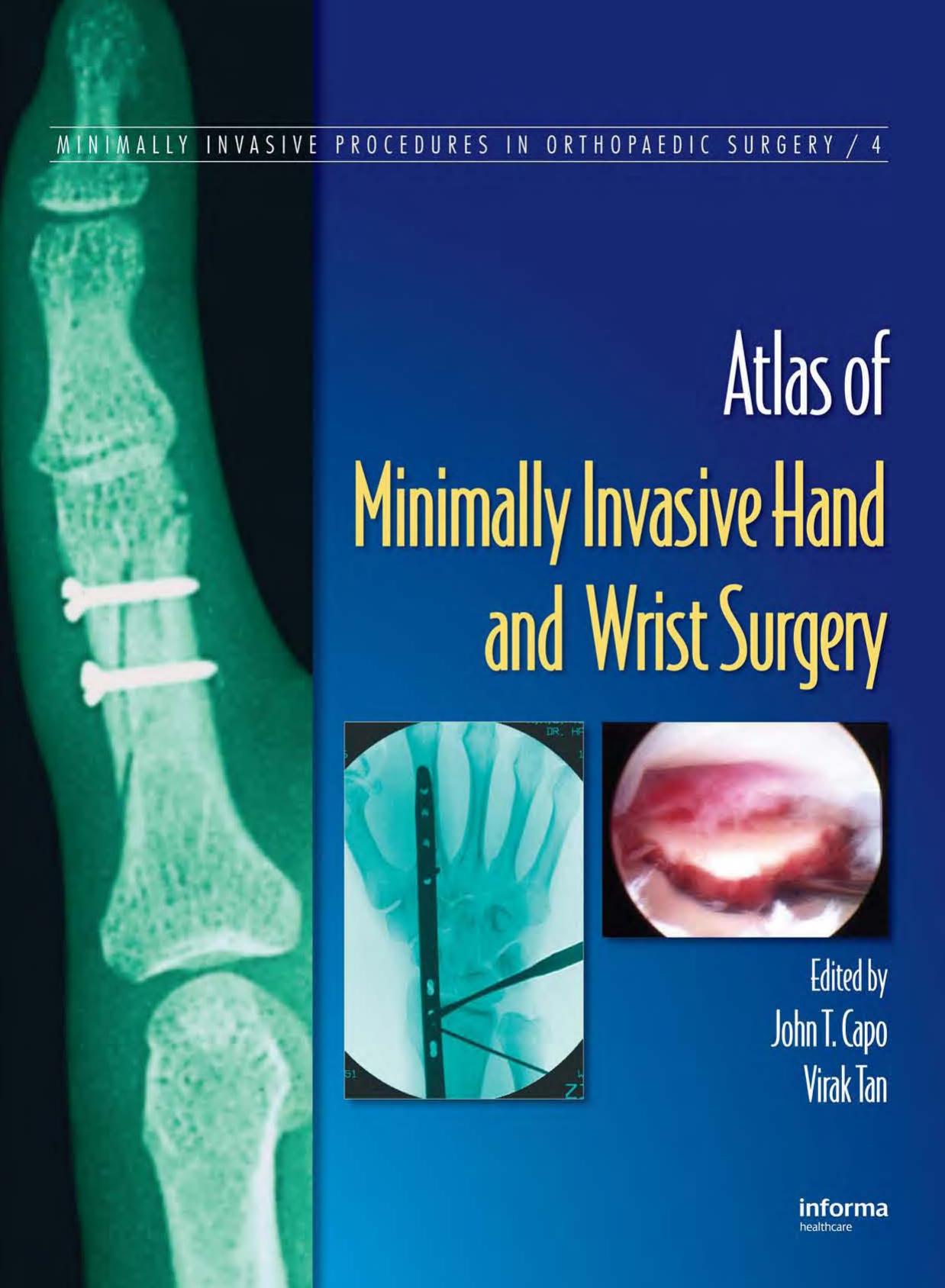 atlas of minimal invasive hand and wrist surgery by Unknown