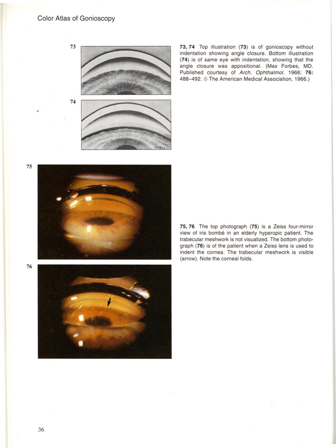 color atlas of gonioscopy by Unknown