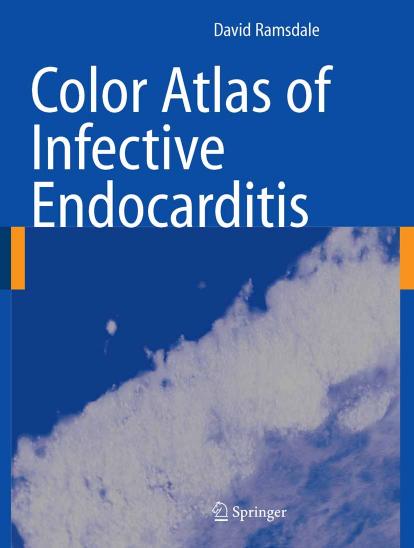 color atlas of infective endocarditis by Unknown