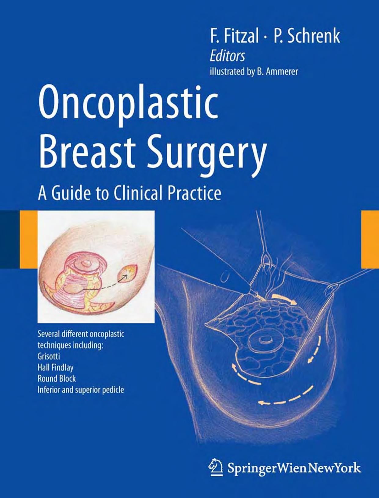 oncoplastic breast surgery a guide to clinical practice.EBOOKOID by Unknown