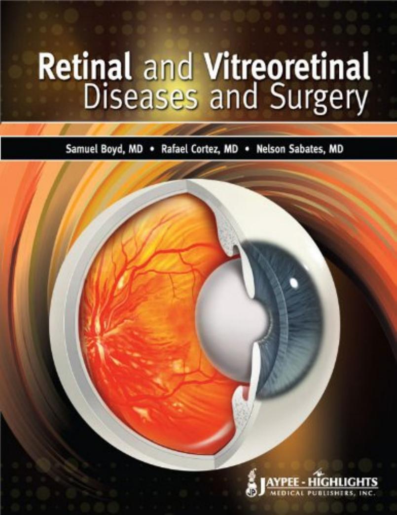 retinal and vitreoretinal diseases and surgery by Unknown